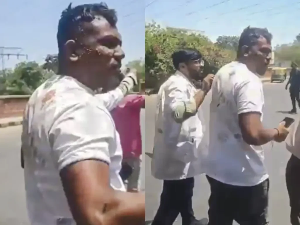 "पापा, मैं बच गया!" – अहमदाबाद प्लेन क्रैश में जिंदा बचे विश्वास रमेश की कहानी रुला देगी 1 ahmedabad-plane-crash